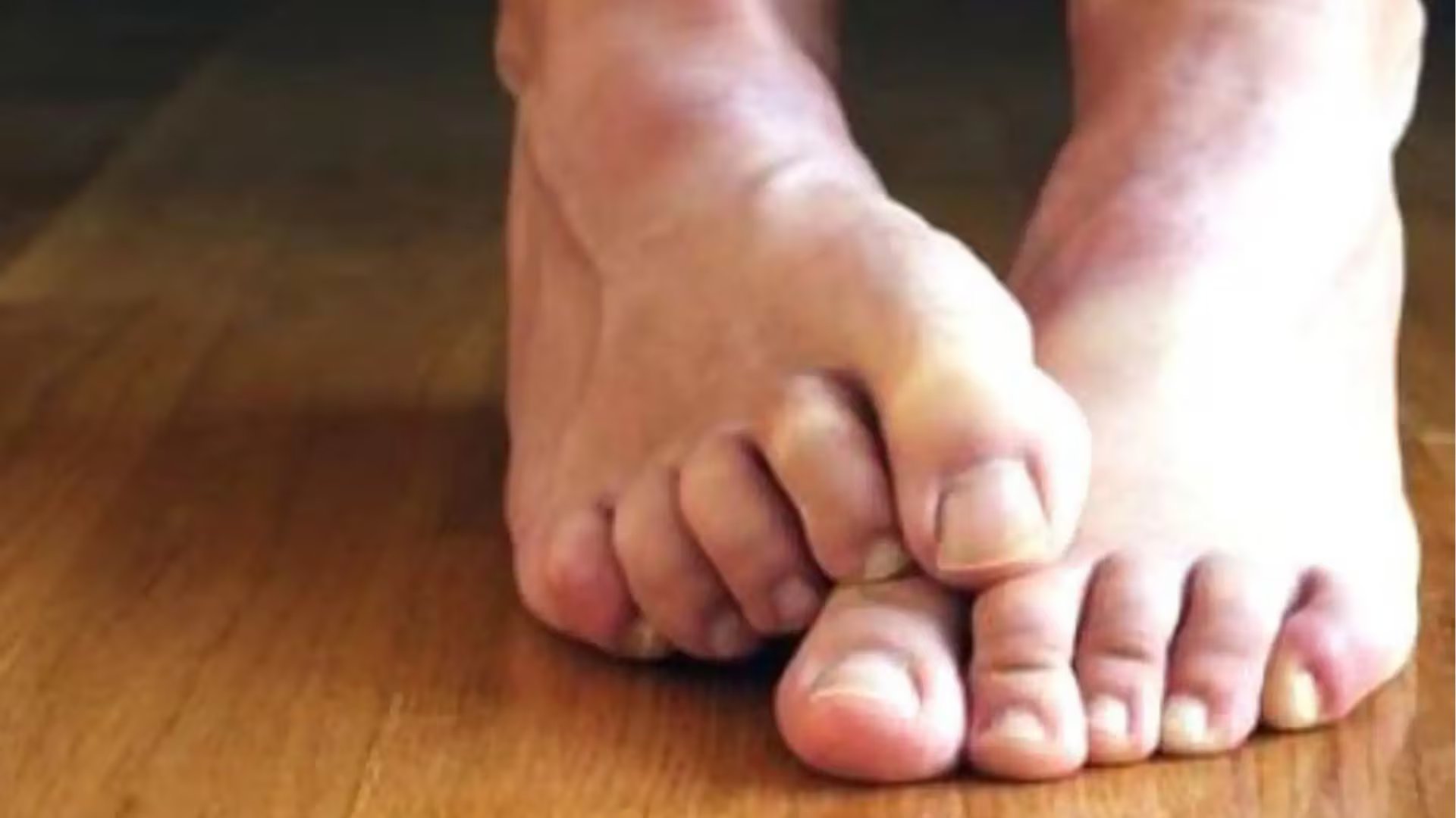 Los especialistas destacan la prevención como factor clave contra las infecciones por hongos en las uñas - crédito Agencia Andina