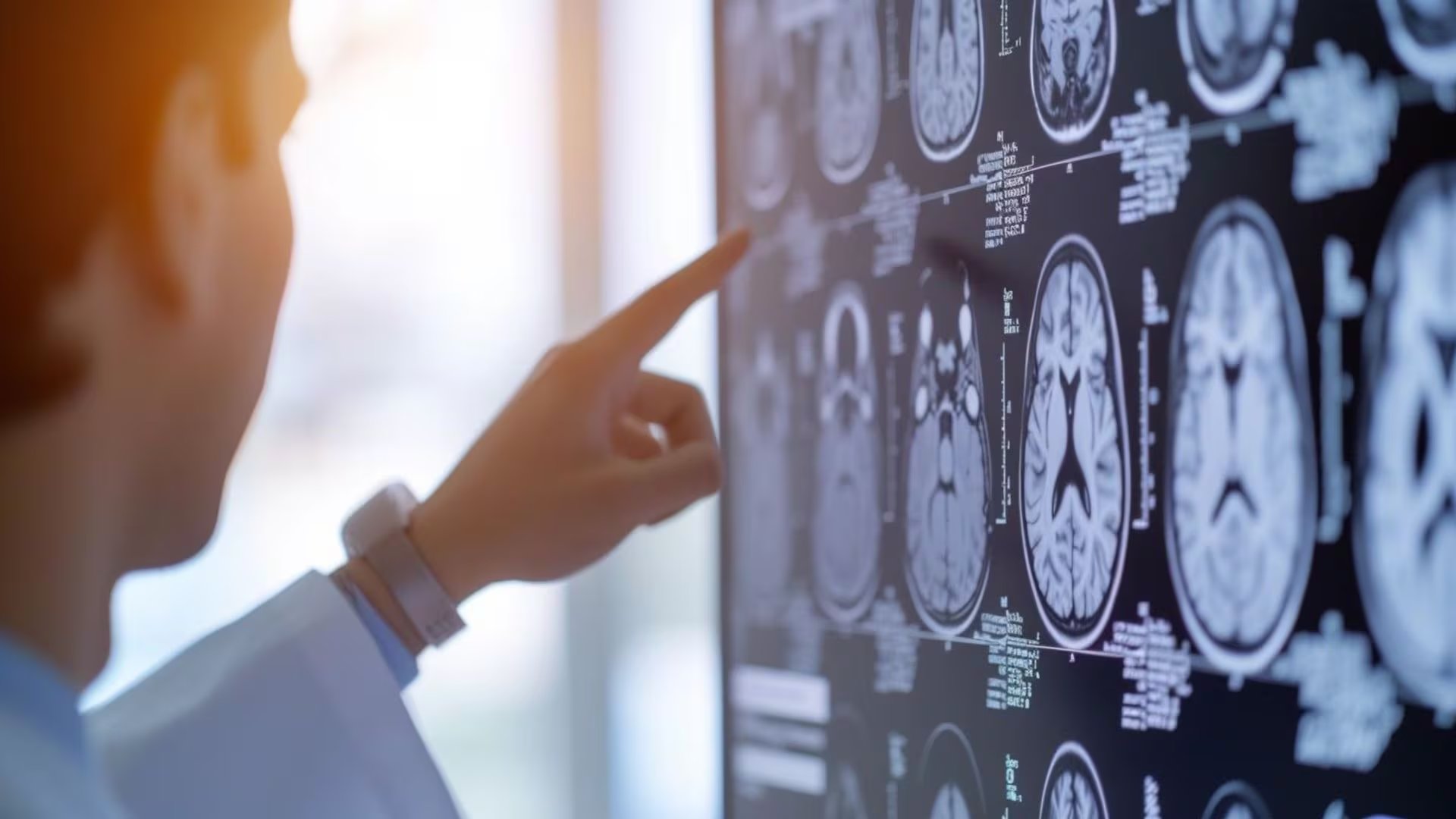 Identificar y actuar a tiempo ante la ineficacia del tratamiento es clave para mejorar el pronóstico y calidad de vida de personas con epilepsia resistente (Imagen Ilustrativa Infobae)