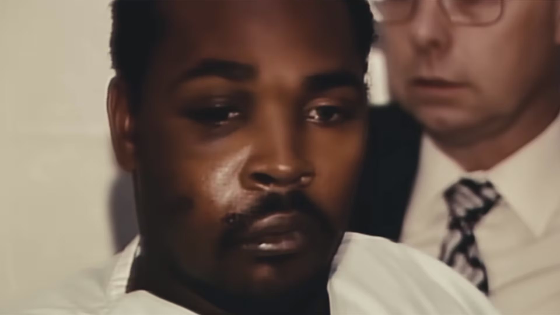 El video del brutal arresto de Rodney King expuso la violencia policial y el racismo sistémico en Estados Unidos. La foto muestra cómo quedó la cara de King