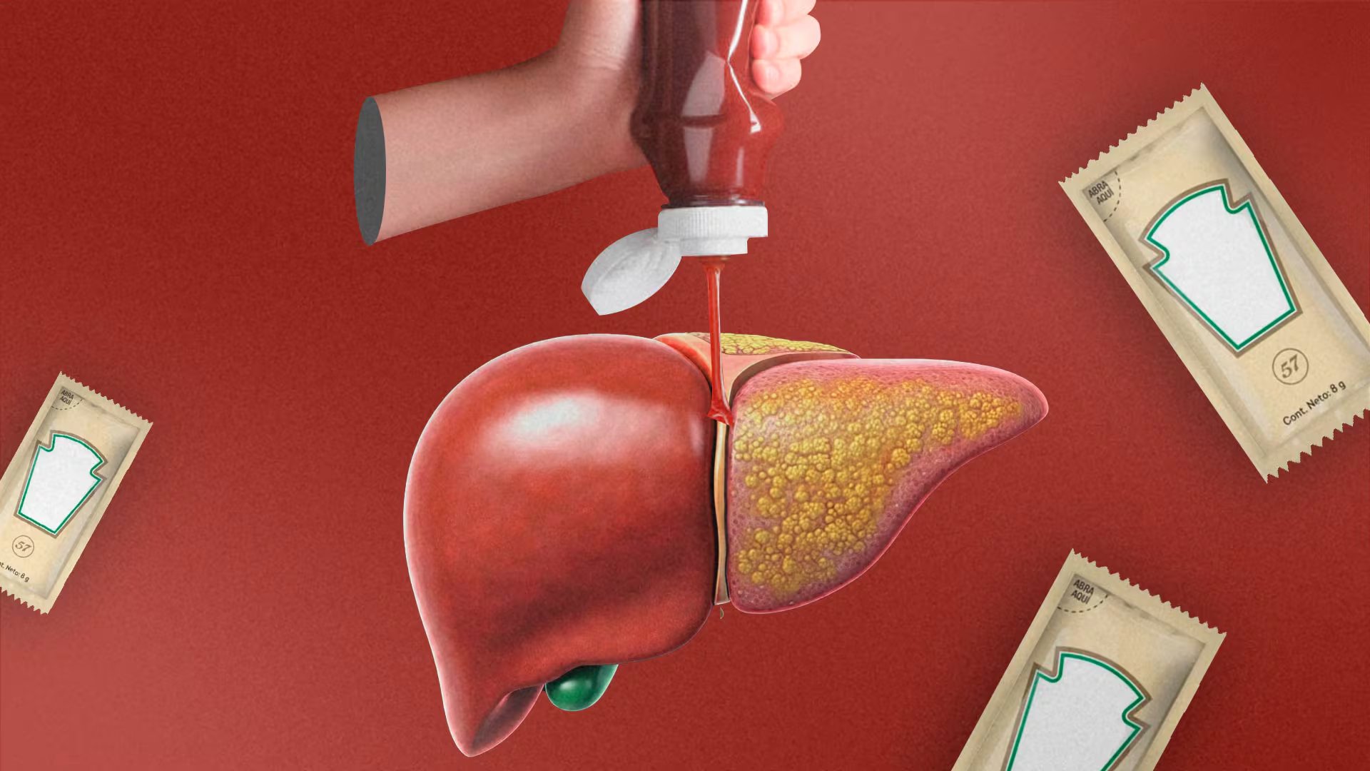 El Dr. Esteban González Ballerga advirtió que el hígado graso es una enfermedad silenciosa, con síntomas que suelen aparecer cuando el daño hepático ya es grave
