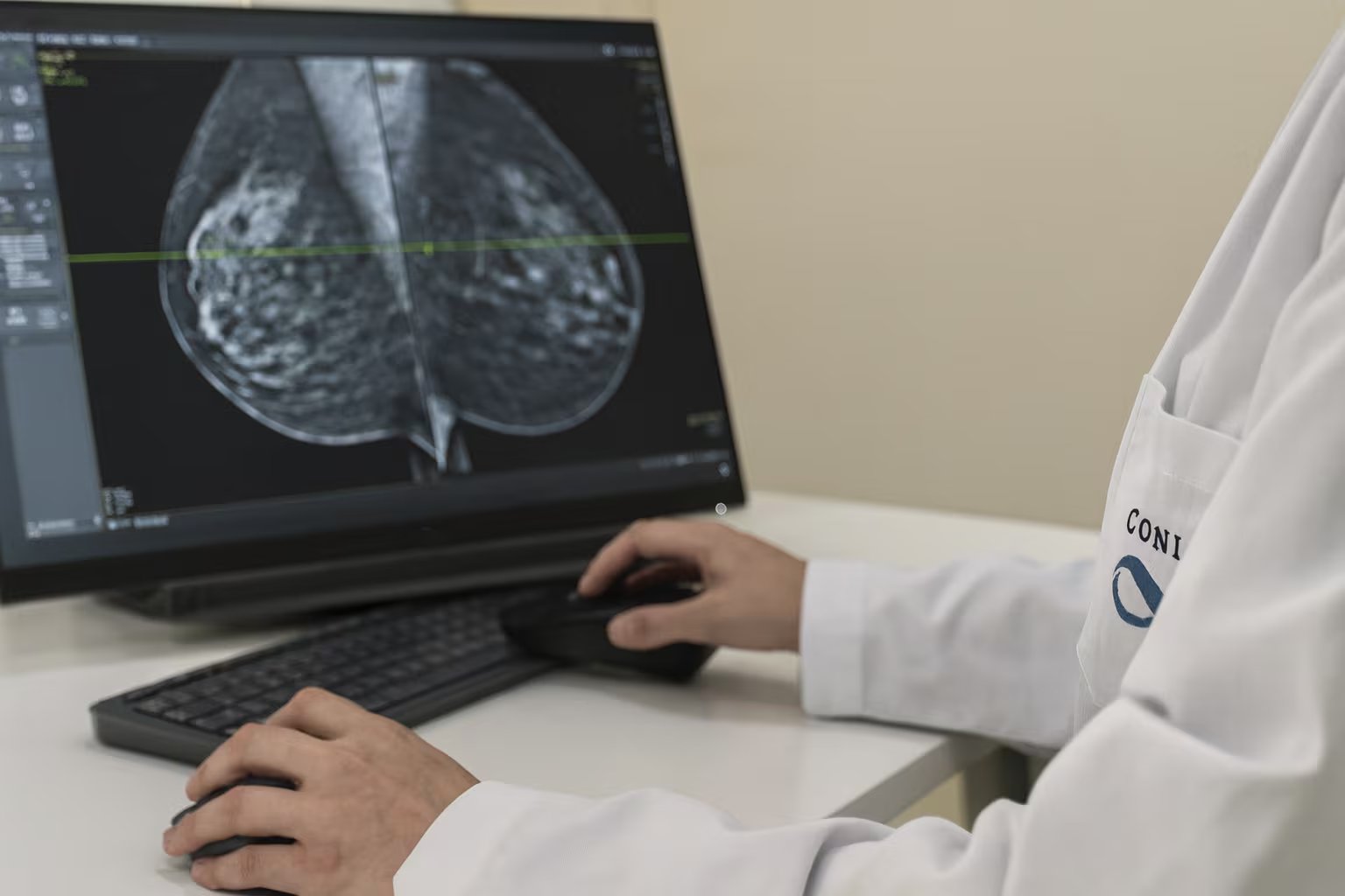 La enfermedad periodontal permite que la bacteria Fusobacterium nucleatum alcance el tejido mamario y favorezca la progresión tumoral (Imagen Ilustrativa Infobae)