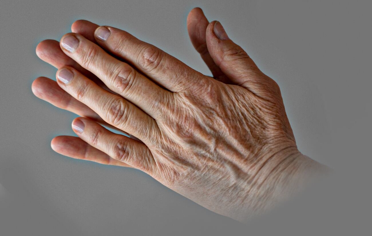 La demanda de tratamientos estéticos para las manos, como los trasplantes de grasa, supera los USD 10.000 y se suman a cirugías faciales
