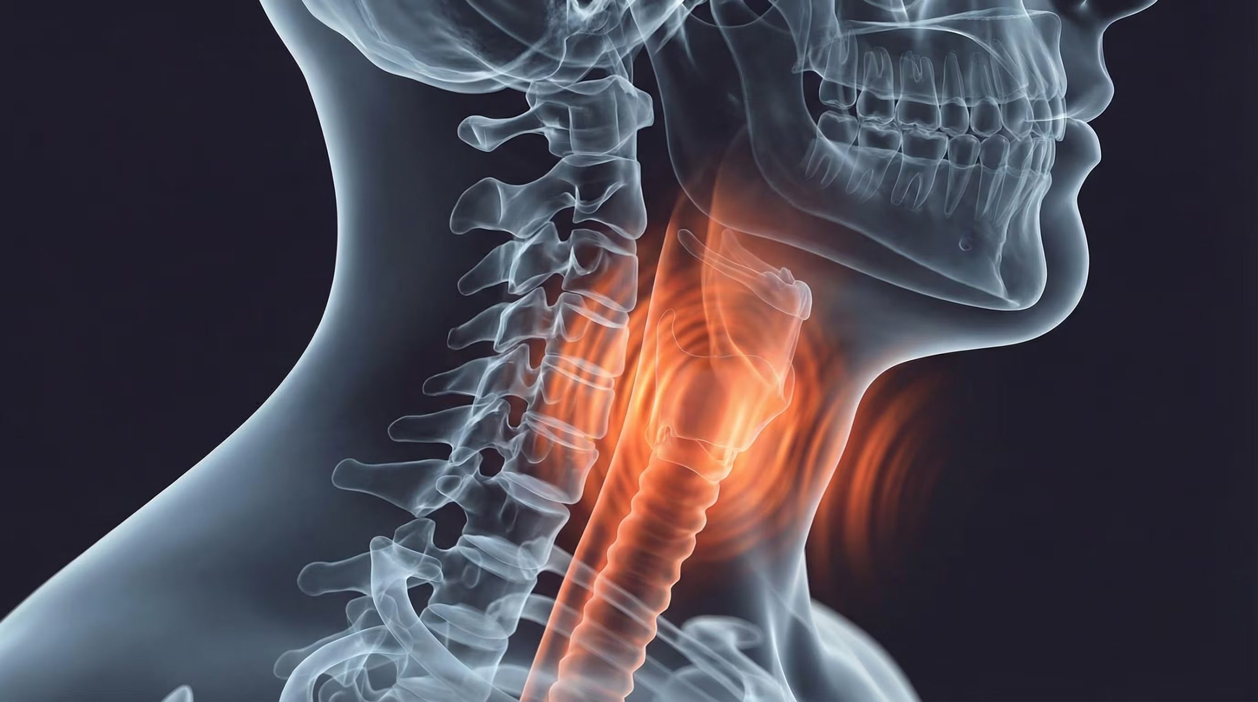 El colapso o estrechamiento de las vías respiratorias superiores durante el sueño provoca interrupciones en la respiración y afecta el descanso
(Imagen Ilustrativa Infobae)