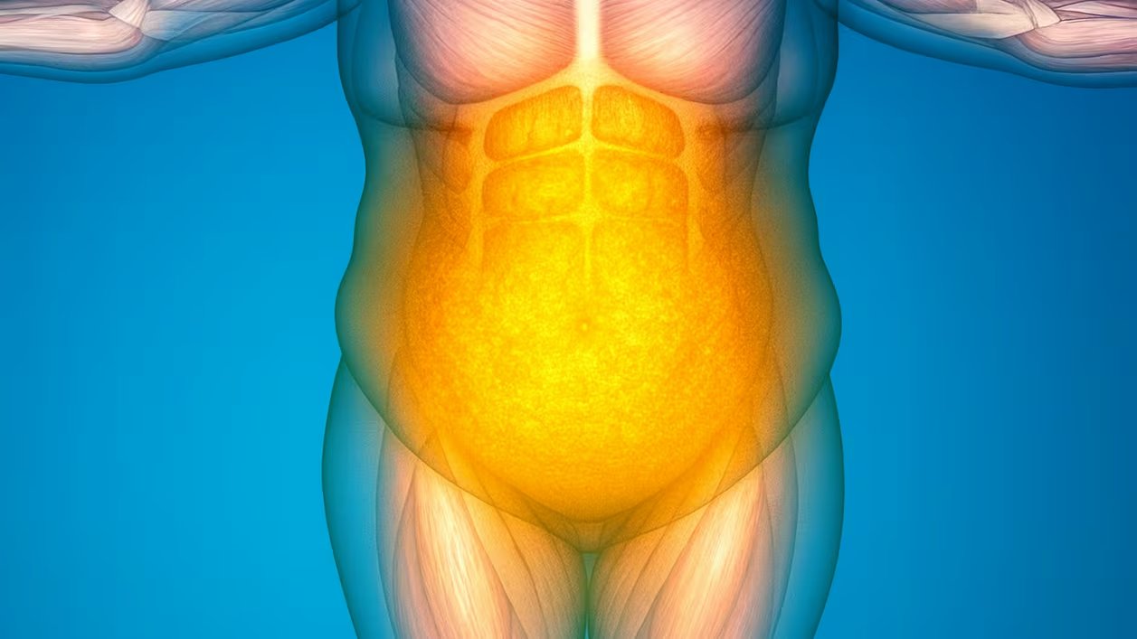 La acumulación de grasa visceral en hombres incrementa el riesgo de diabetes tipo 2 y enfermedad cardiovascular (Imagen ilustrativa Infobae)