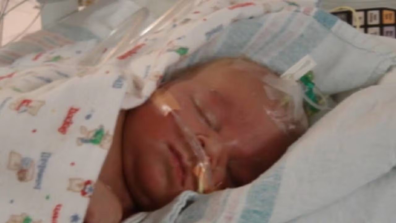 El avance de la cirugía fetal en el UCSF ha motivado a hospitales y profesionales de todo el mundo a replicar la técnica FETO en casos seleccionados. (abc7news)