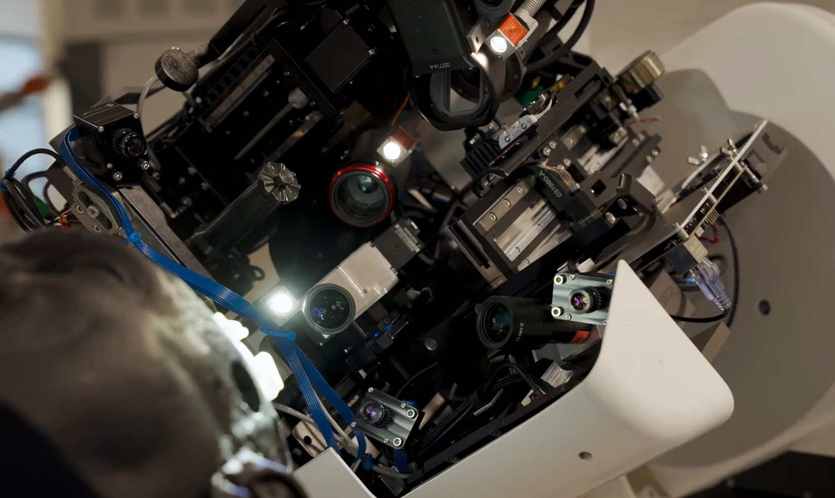 La empresa afirma que el aprendizaje es constante y que el equipo evalúa mejoras de manera continua. (X: Neuralink)