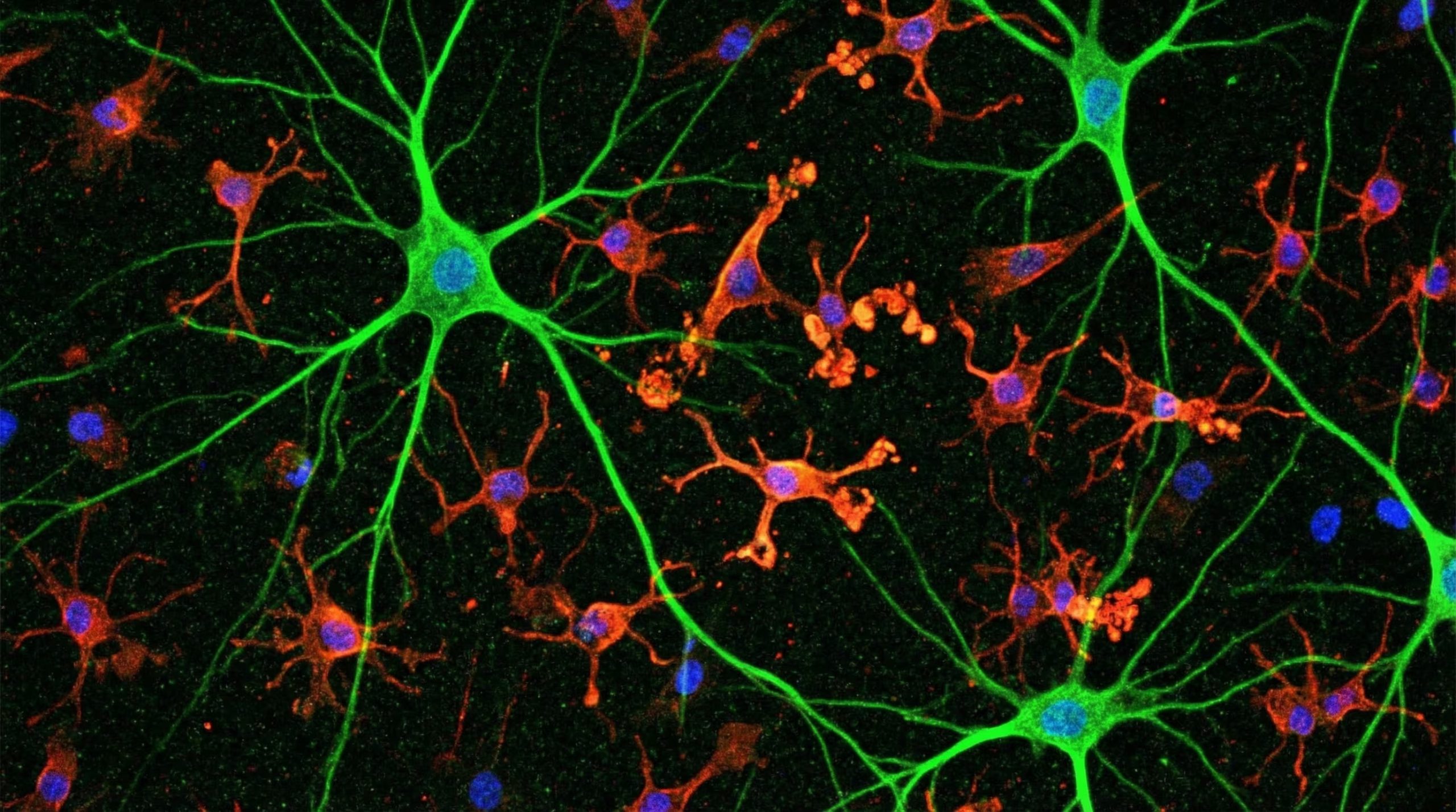 Una imagen microscópica muestra células gliales rojas y neuronas verdes con núcleos azules, destacando signos de envejecimiento o inflamación en algunas estructuras celulares. (Imagen Ilustrativa Infobae)
