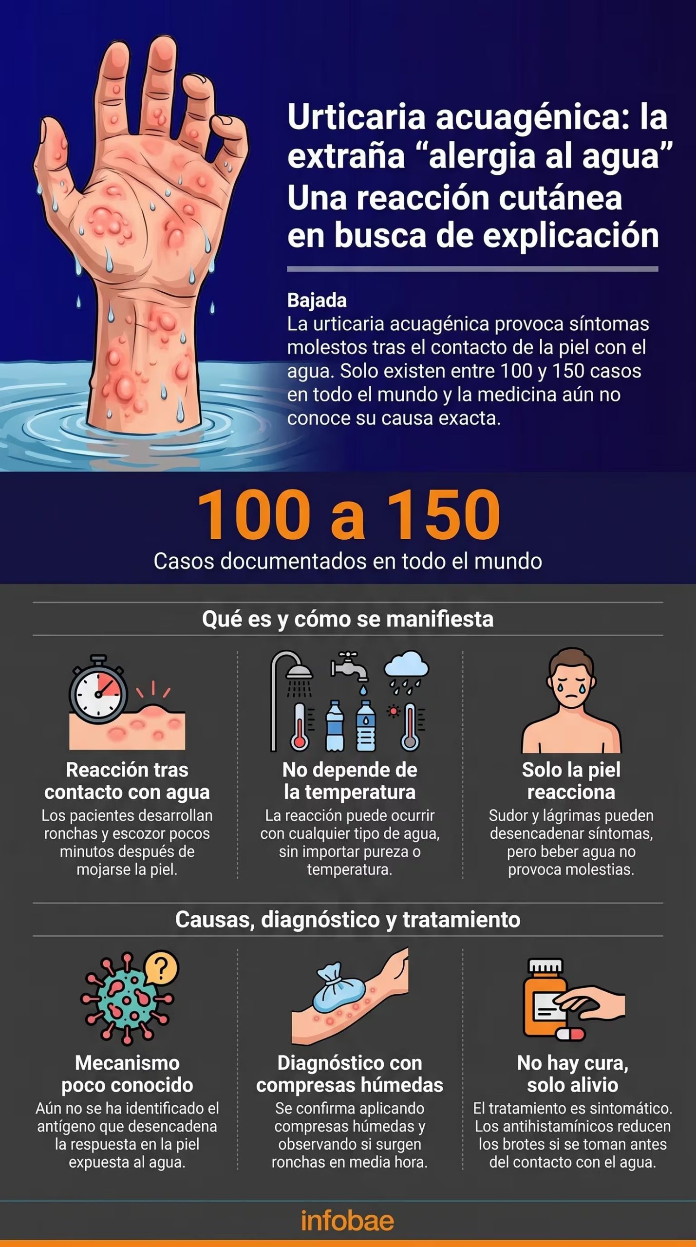 La urticaria acuagénica no se clasifica como una alergia tradicional, pues no implica los mecanismos inmunológicos típicos de otras afecciones alérgicas (Imagen Ilustrativa Infobae)