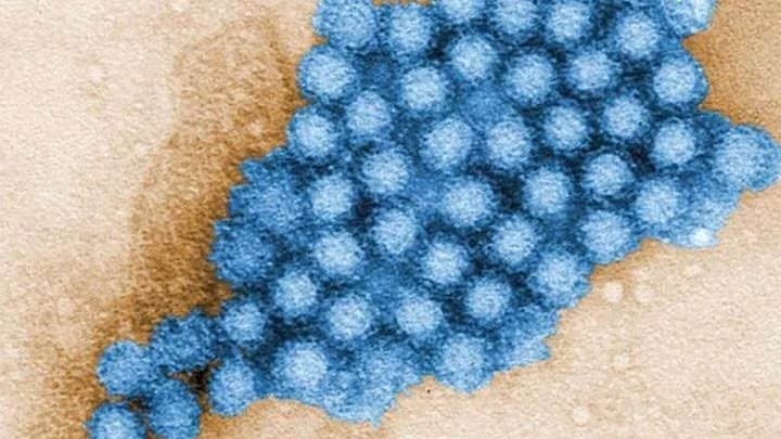 La transmisión del norovirus es sencilla en espacios cerrados con mucha gente, como los cruceros, donde el contacto cercano facilita la propagación (CDC / CHARLES D. HUMPHREY)

