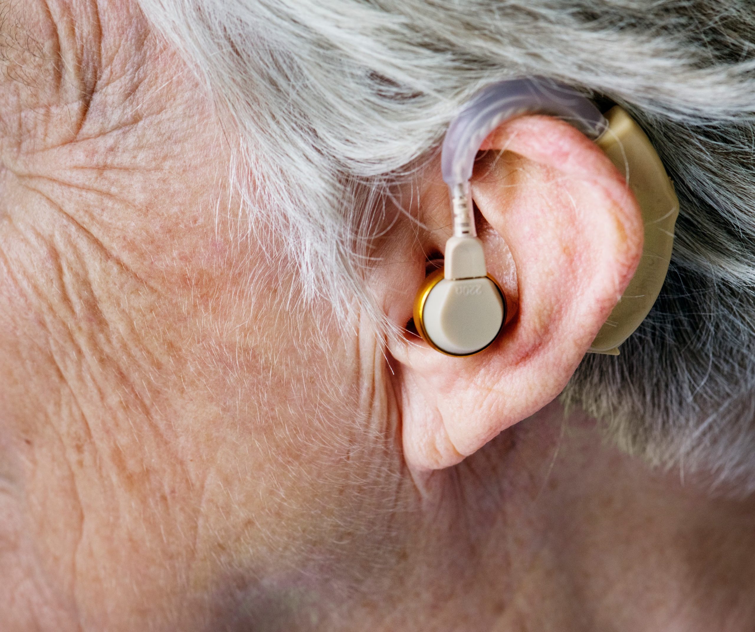 El sistema auditivo cerebral supera la principal limitación de los audífonos tradicionales, que amplifican todos los sonidos sin discriminar (Crédito: Freepik)