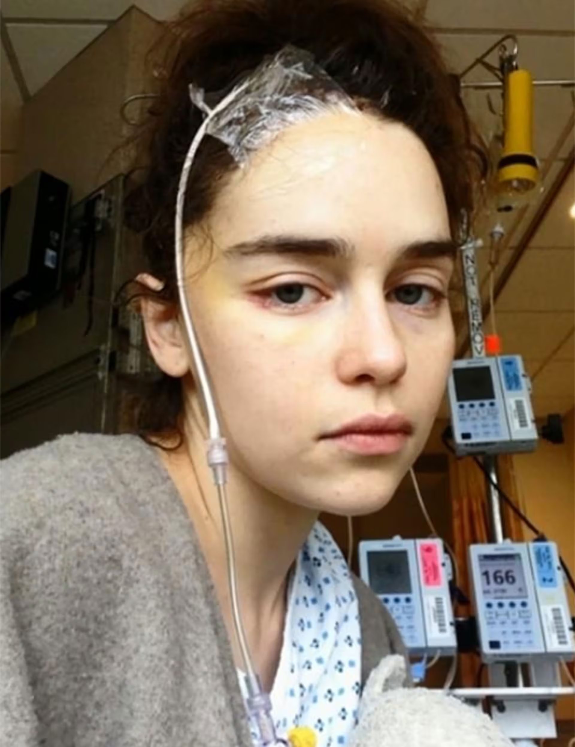 Emilia Clarke fundó la organización SameYou para apoyar a pacientes con lesiones cerebrales.