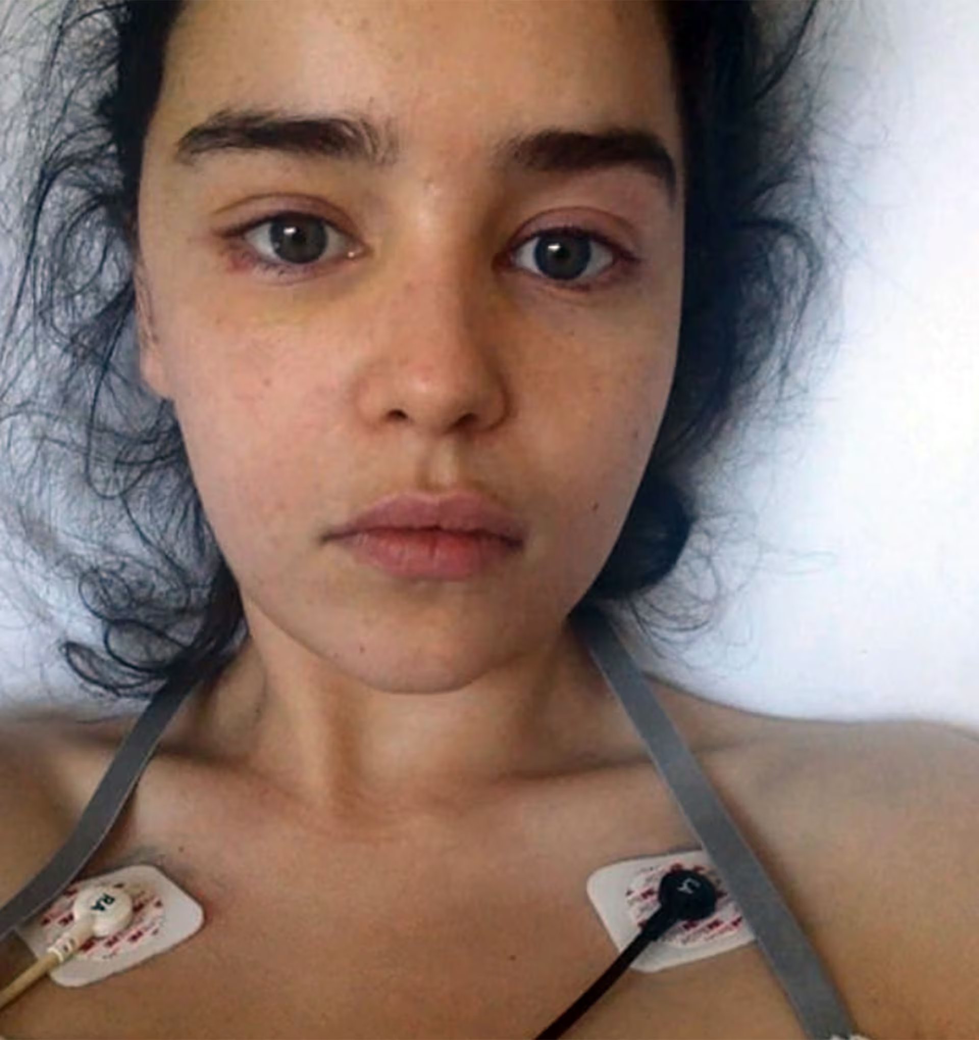 Emilia Clarke confesó que tras su segundo aneurisma atravesó un profundo aislamiento emocional.