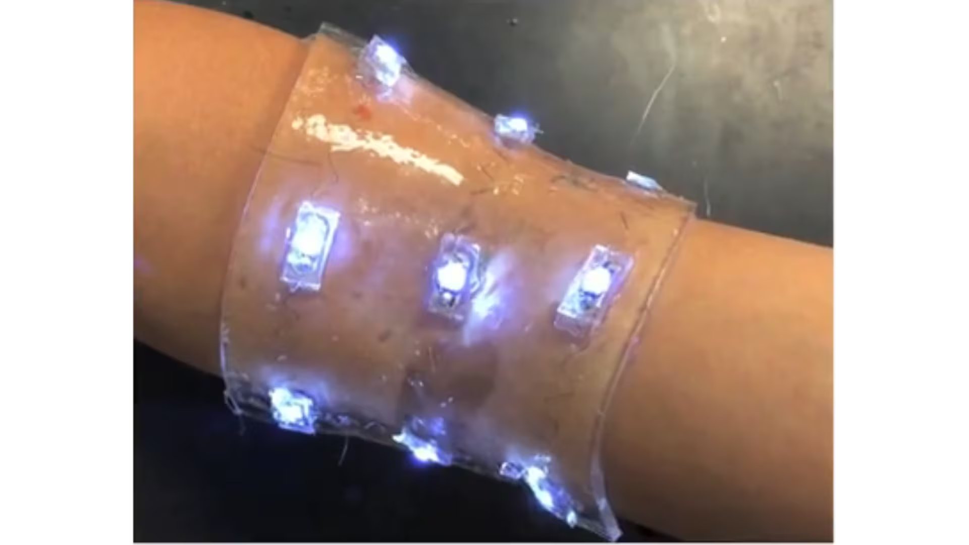 La innovación podría impulsar el desarrollo de fuentes de energía flexibles para la electrónica portátil y médica. (Imagen referencial/MIT)