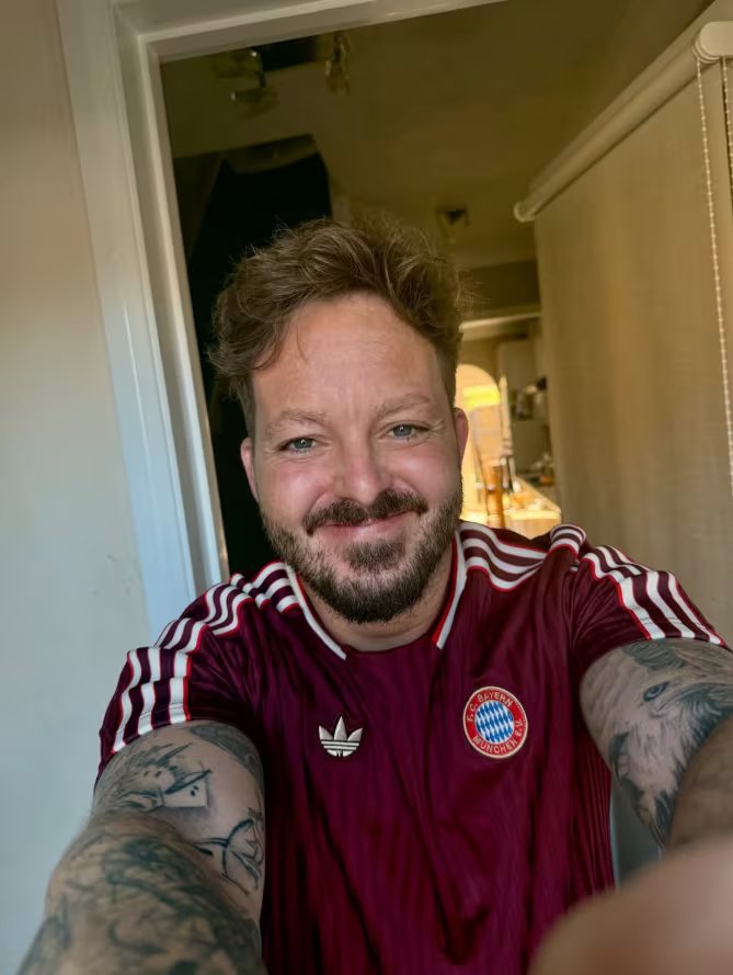 La neurofibromatosis tipo 2 puede pasar inadvertida cuando síntomas como sordera, debilidad en las piernas o falta de coordinación se confunden con el envejecimiento (Michael Archer Instagram)