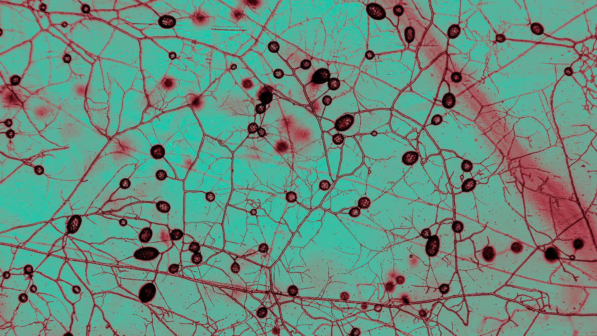 Los suelos superiores del planeta contienen unos 110 cuatrillones de kilómetros de redes fúngicas vivas, según el nuevo mapa global de hongos/ Tomás Munita