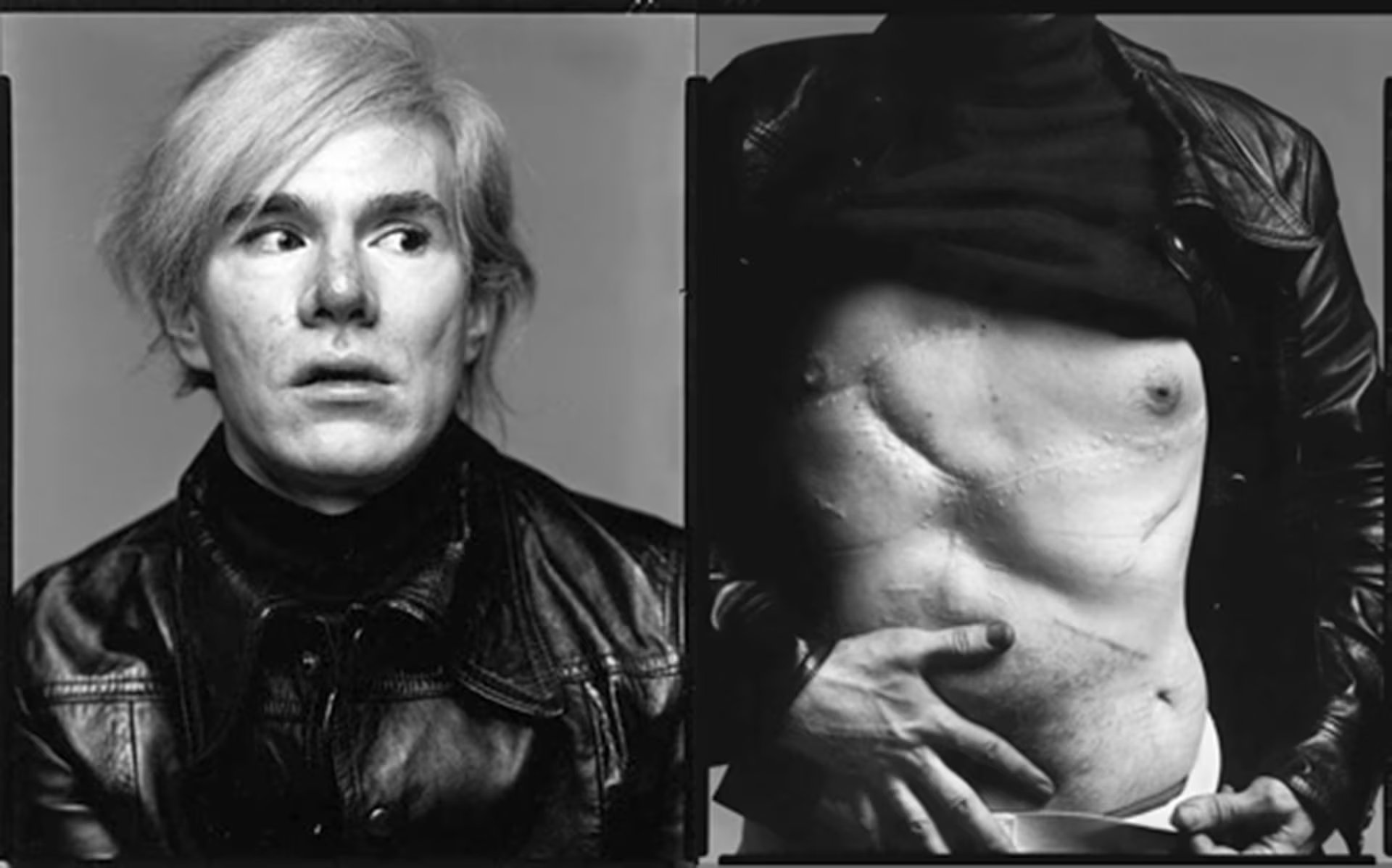 Después de sobrevivir al ataque que casi lo mata Andy Warhol mostró las cicatrices