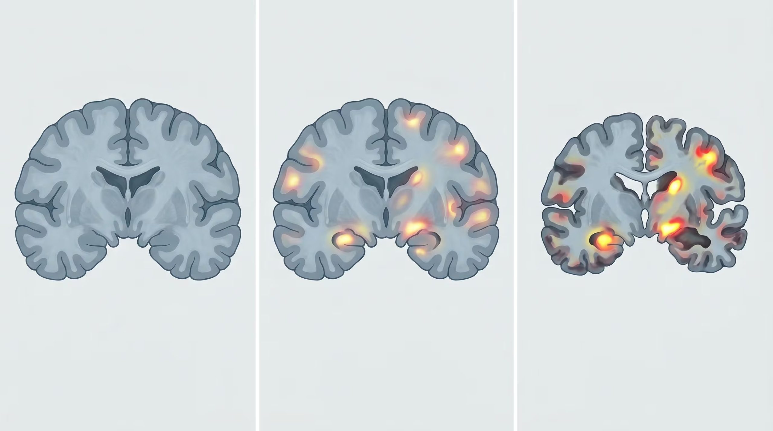 La investigación analizó imágenes cerebrales de más de 47.000 adultos de Estados Unidos y Reino Unido (Imagen Ilustrativa Infobae)