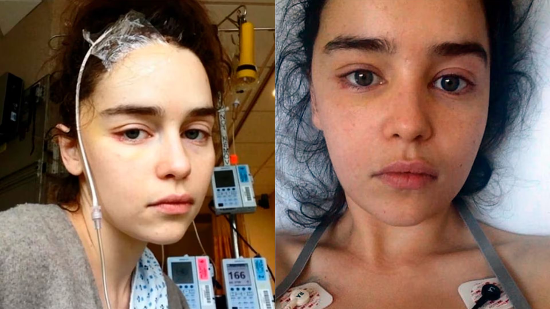 La actriz británica prioriza proyectos artísticos que favorecen su bienestar emocional y tienen impacto en la recuperación de lesiones cerebrales - (Foto: Emilia Clarke)