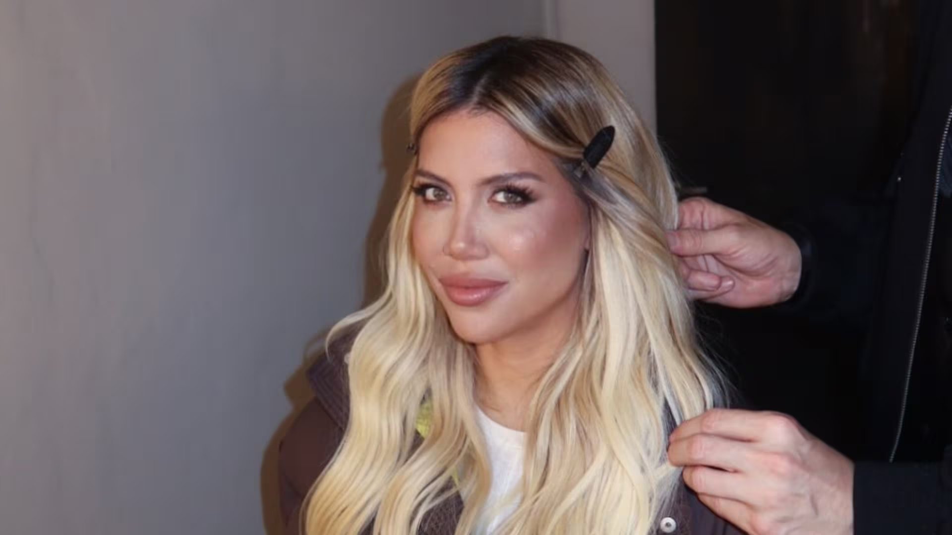 Los seguidores de Wanda Nara votaron en su mayoría por conservar los lunares como parte de su imagen
