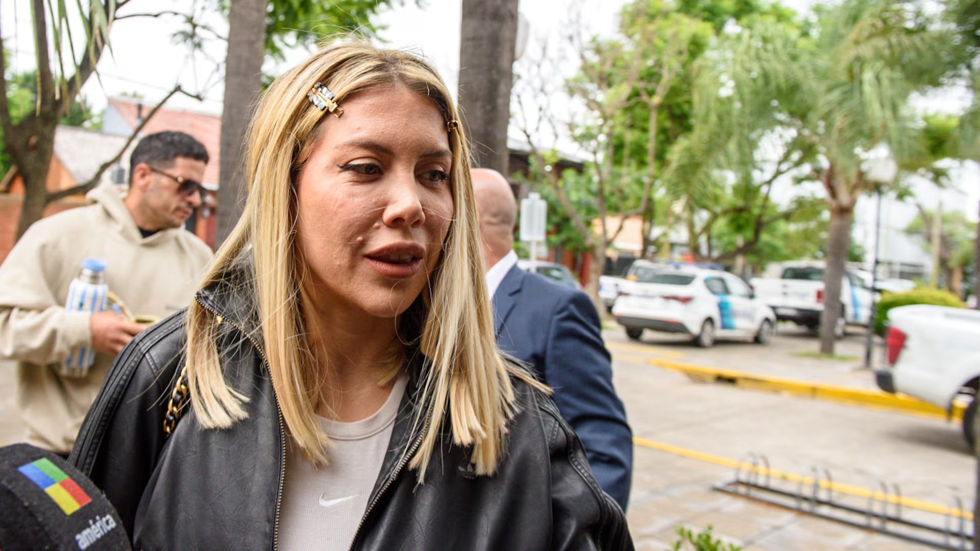 Wanda Nara contó que los lunares están junto a su nariz y que forman parte de su rostro desde que nació