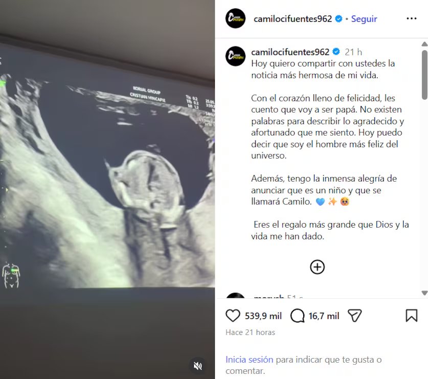 Creador de contenido anónimo, Camilo Cifuentes, confirmó el embarazo de su pareja - crédito @camilocifuentes962/IG