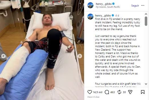 El influencer todavía evalúa publicar la parte más impactante del video debido a la crudeza de las imágenes. (Créditos: Henry Gibbs)