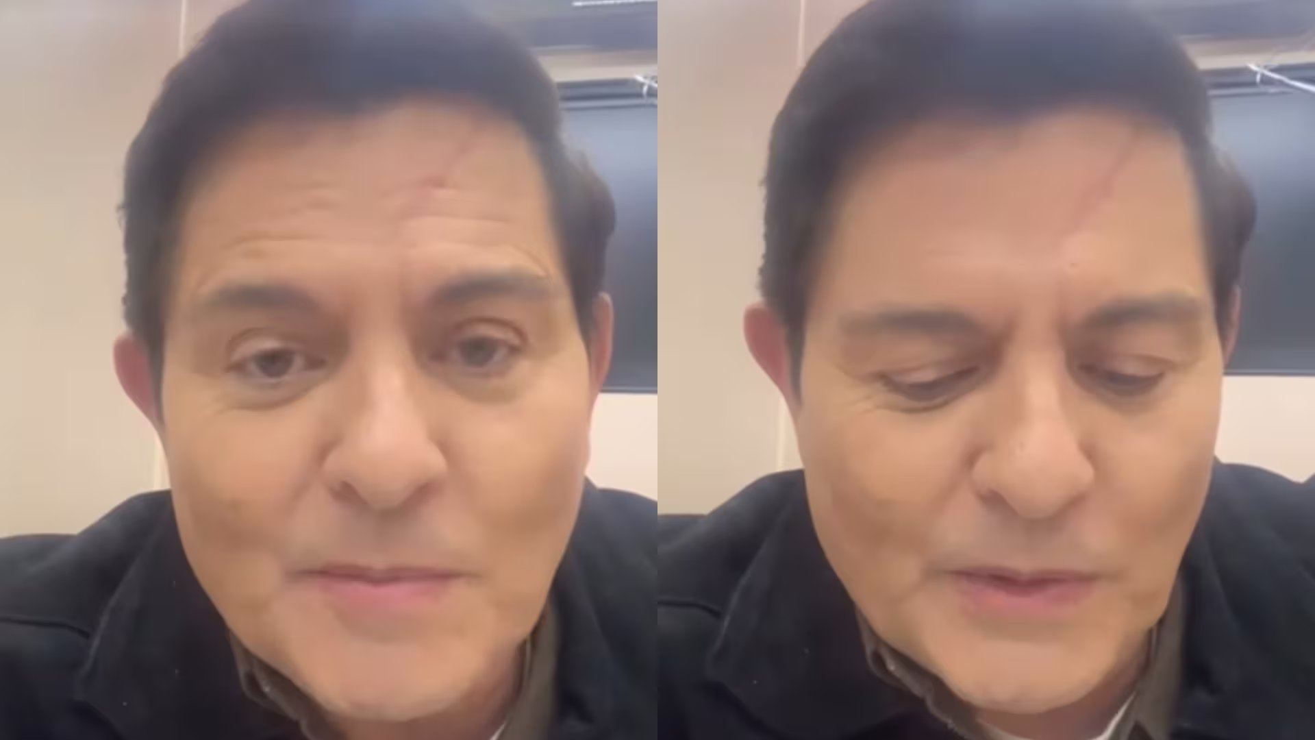 Ernesto Laguardia reaparece tras sufrir aparatoso accidente; posible lesión en su rostro alarma: “Momento difícil” 
(Crédito: Instagram/Ernesto Laguardia )