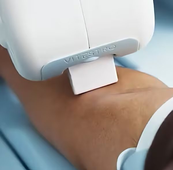 La revista Clinical Chemistry publicó una evaluación del sistema Aletta en tres laboratorios ambulatorios: logró un 94,5% de éxito al primer intento cuando detectó una vena apta (Captura de video)