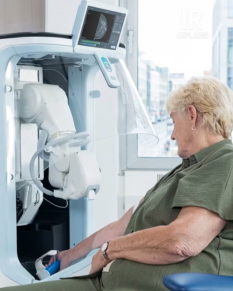 La tecnología incorpora sensores para detectar movimientos que comprometan la punción: ante una señal de riesgo, la aguja se desprende y el procedimiento se interrumpe (Captura de video)