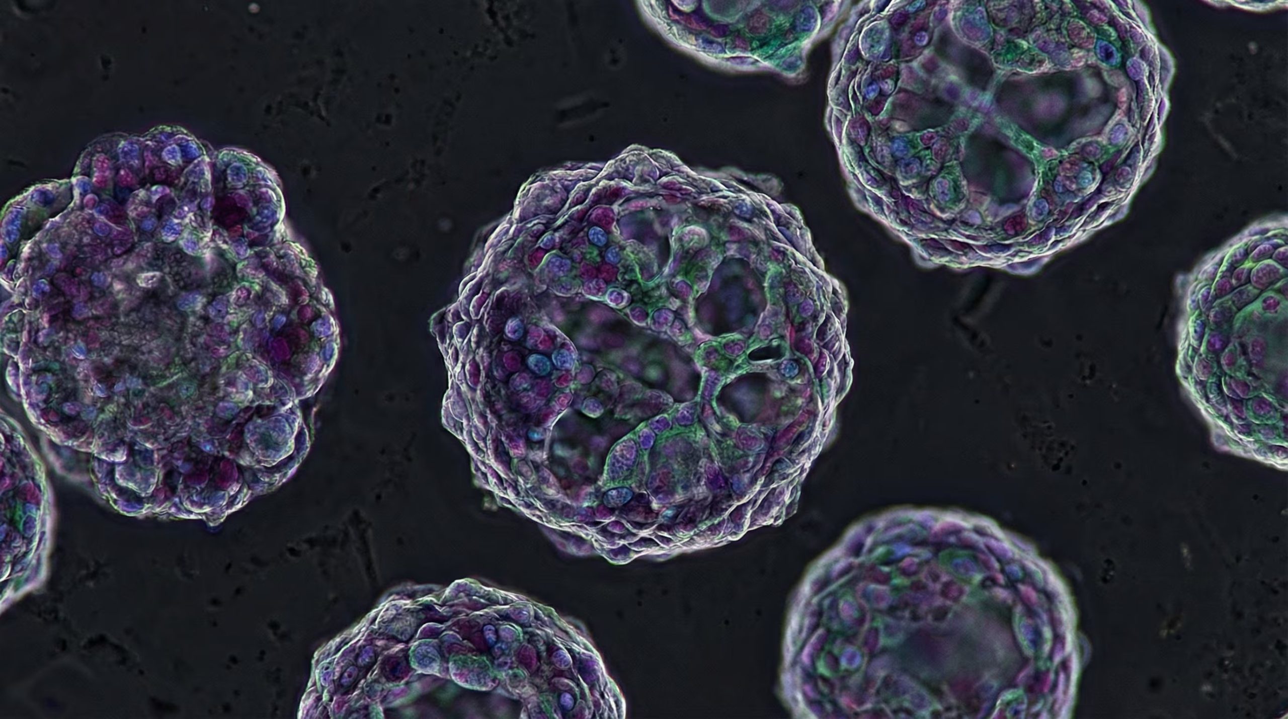 Los organoides cerebrales registraron el paso del tiempo y conservaron memoria celular de su edad de desarrollo durante el experimento (Imagen Ilustrativa Infobae)