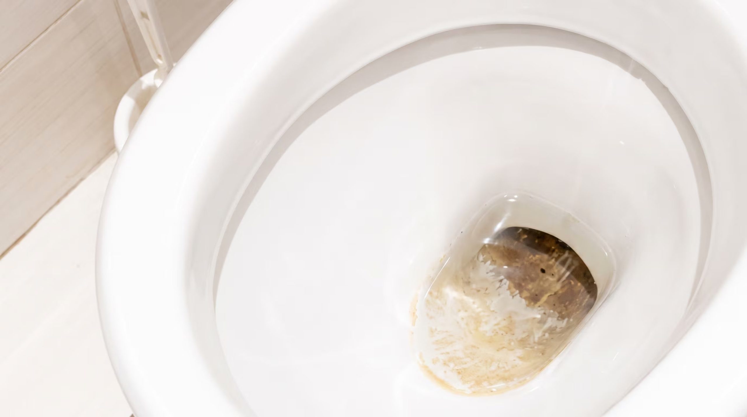 Una limpieza incorrecta ralla la porcelana, facilitando que el sarro se adhiera y sea más difícil de quitar. (Imagen Ilustrativa Infobae)