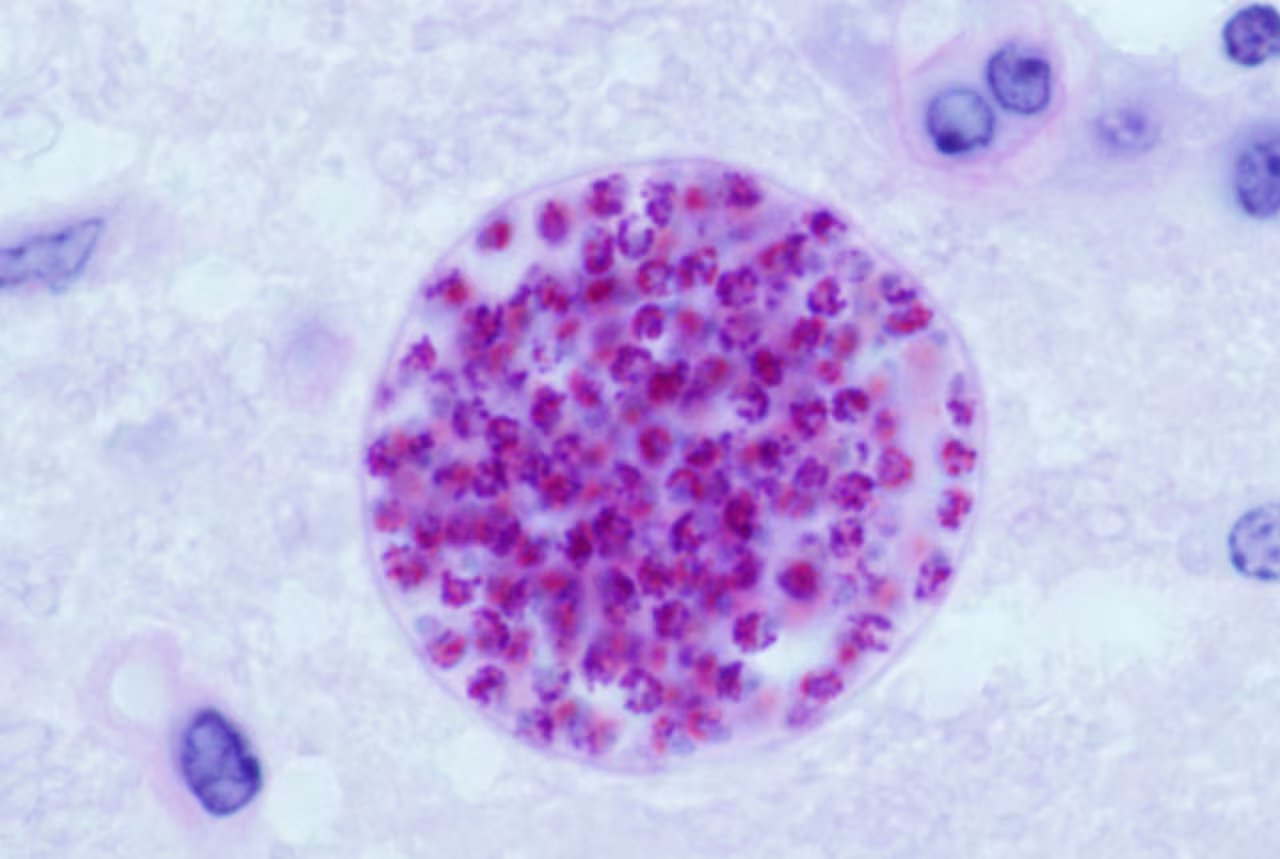 Las principales complicaciones asociadas a Toxoplasma se presentan durante el embarazo y en personas con inmunodeficiencias graves (Wikipedia)