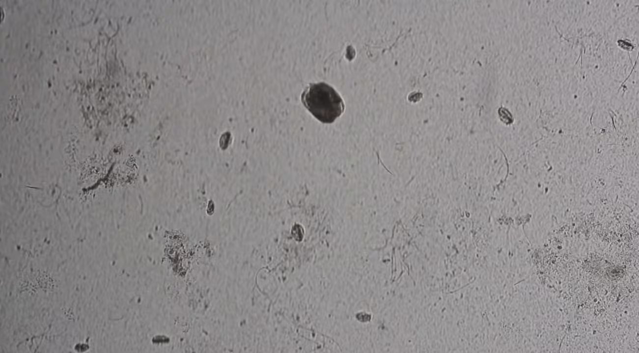 El cambio modifica la estrategia alimentaria: las células dejan de explotar bacterias y pasan a depender de presas de la misma línea clonal con el mismo ADN (Captura de video)