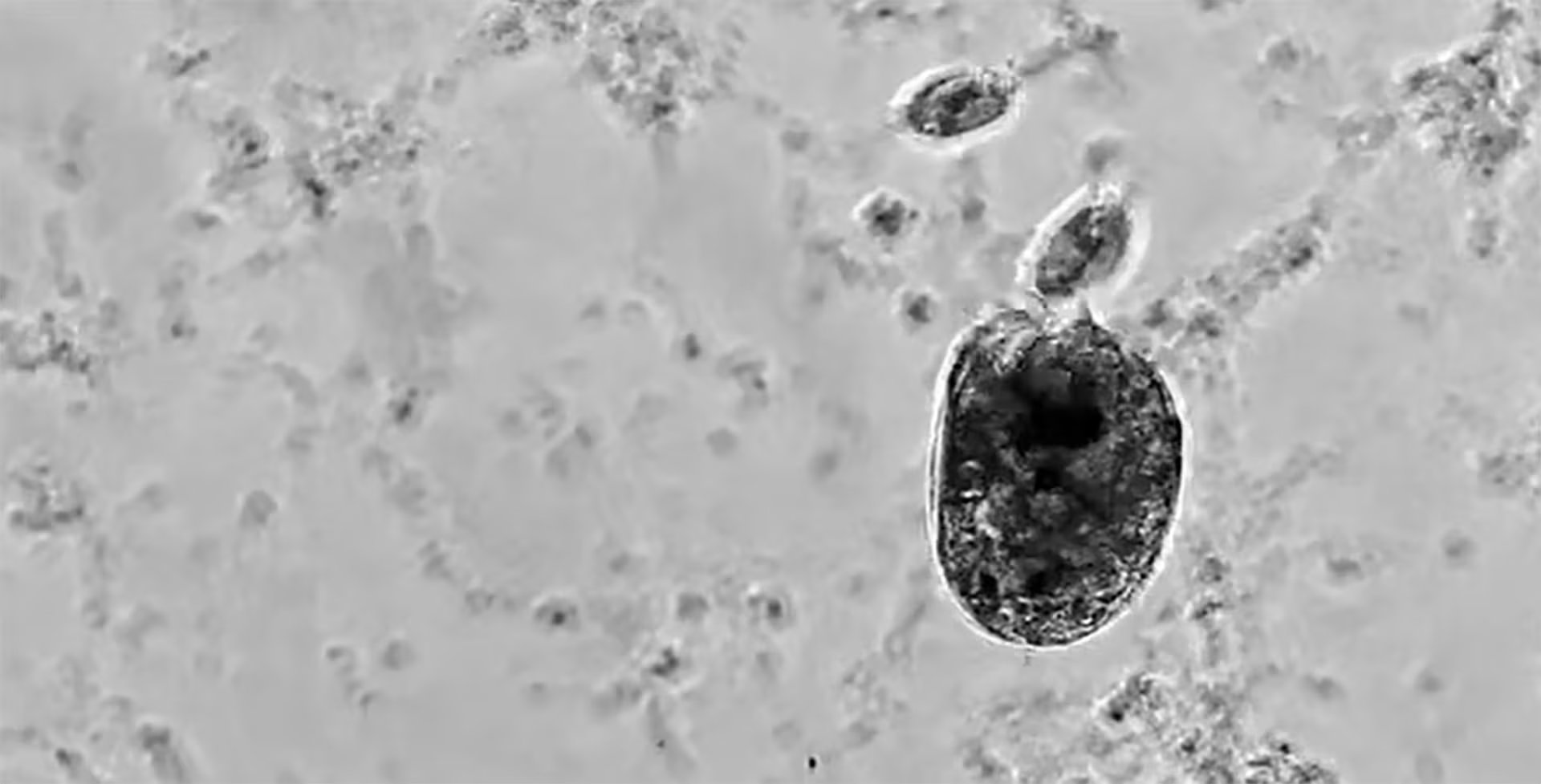 Investigadores identificaron en Curazao a Euplotes gigatrox, una nueva especie de ciliado capaz de convertirse en una célula supergigante con comportamiento caníbal (Captura de video)