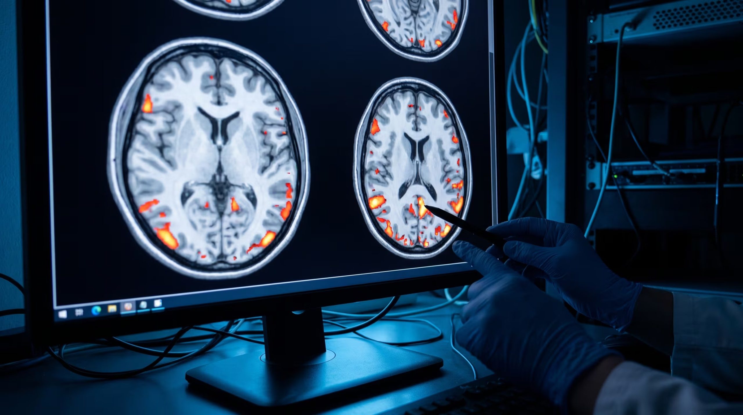 El estudio sobre salud cerebral advierte que estas etapas del cerebro son promedios poblacionales y no edades exactas para cada persona (Imagen Ilustrativa Infobae)