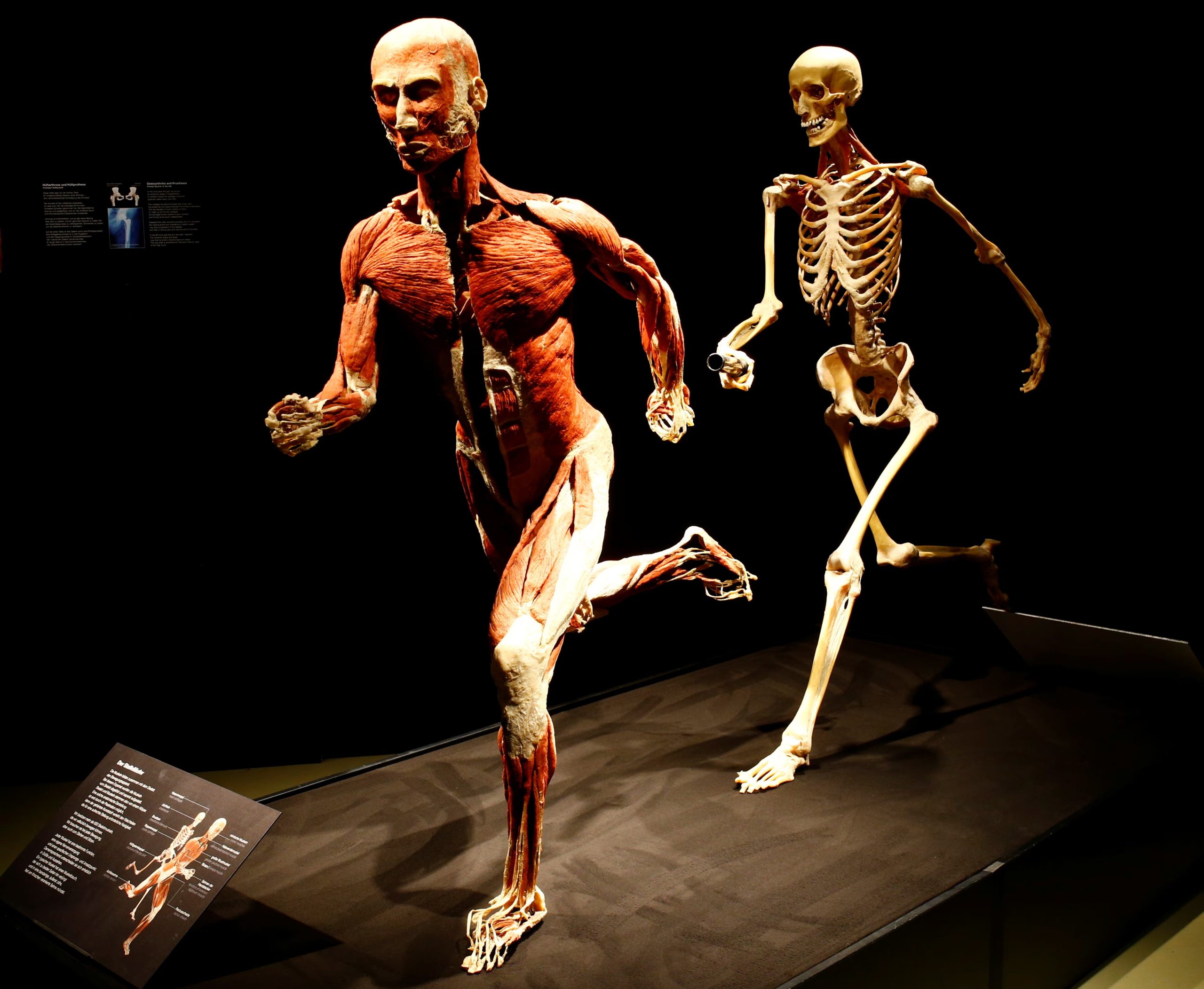 En la Universidad de Heidelberg, Gunther von Hagens desarrolló la idea de la plastinación al preguntarse si era posible introducir plástico dentro del espécimen (REUTERS/Arnd Wiegmann)