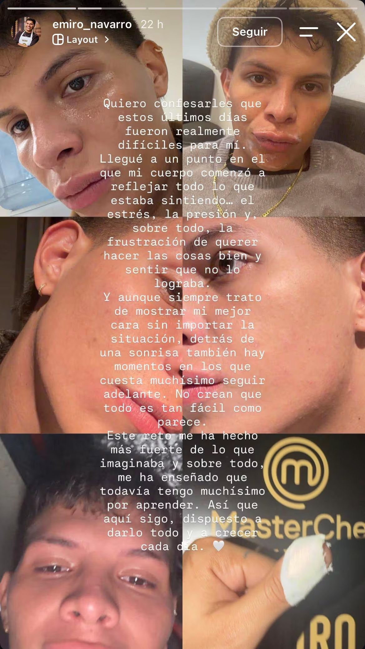 Emiro Navarro compartió con sus seguidores los problemas en la piel que le generaron las grabaciones de 'MasterChef Celebrity' - crédito @emironavarro/IG