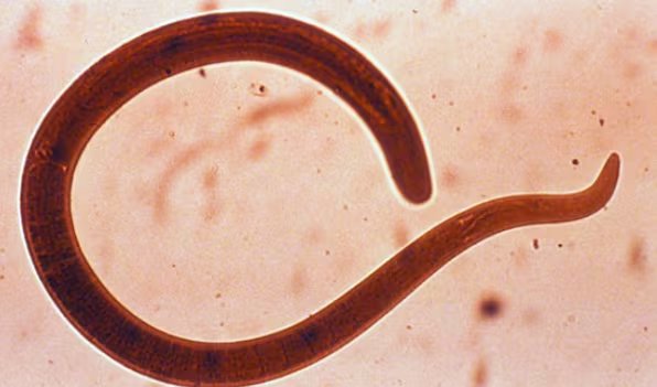  Ascaris lumbricoides visto en microoscopio.(Farmacia Las Fuentes)