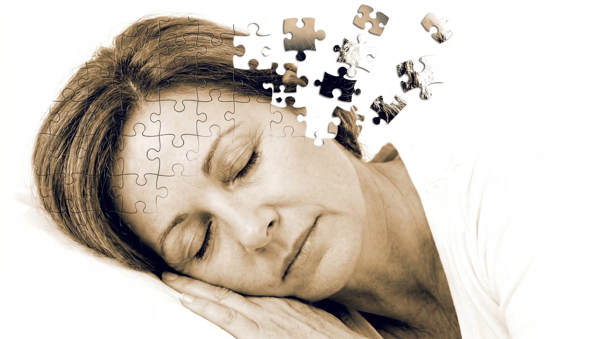 La microglía puede adoptar estados patológicos que amplifican la neuroinflamación, el daño neuronal y la pérdida de sinapsis en el cerebro. (Imagen Ilustrativa Infobae)