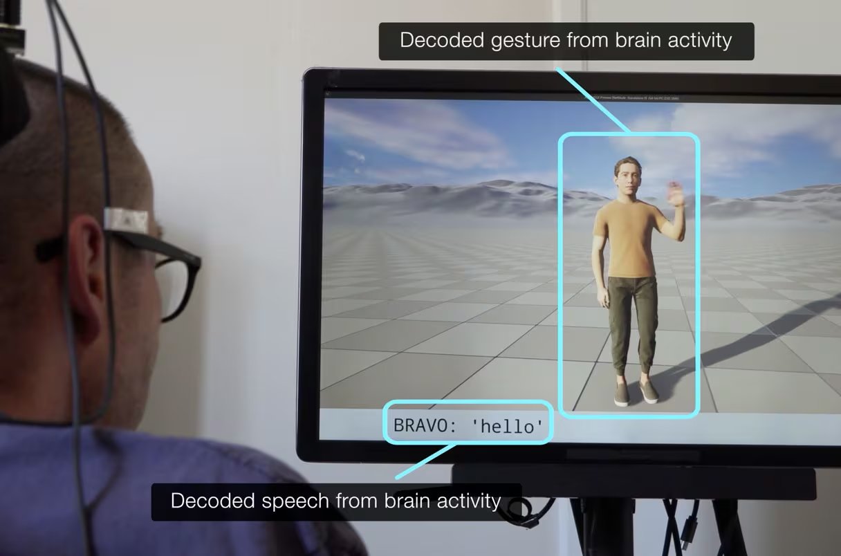 Un paciente con un implante cerebral utiliza un sistema computarizado para controlar los gestos y el habla de un avatar en pantalla (Laboratorio Chang/Universidad de California en San Francisco)
