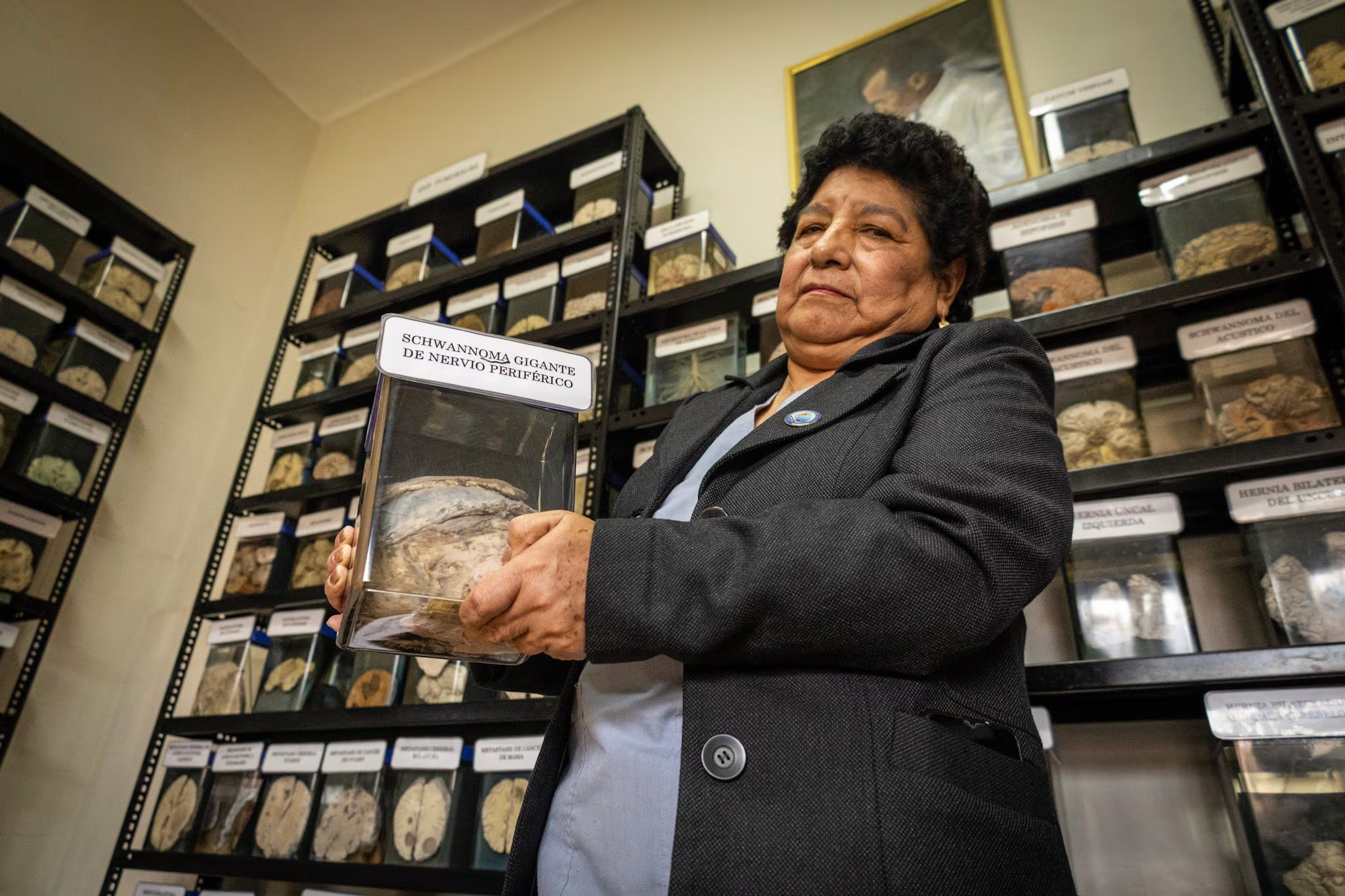Los cerebros y otras muestras se conservan en formol al 10%. (Paula Elizalde)