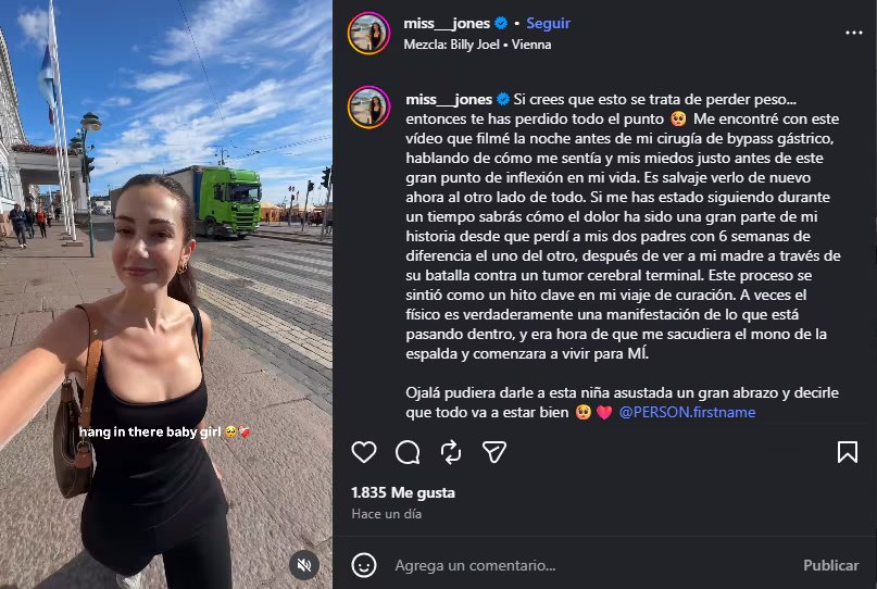 Jones compartió un video sobre los miedos que sentía antes del bypass gástrico, donde además reflexionó sobre las críticas que ha recibido a lo largo de su cambio corporal
(Créditos: Instagram/Emily jones)